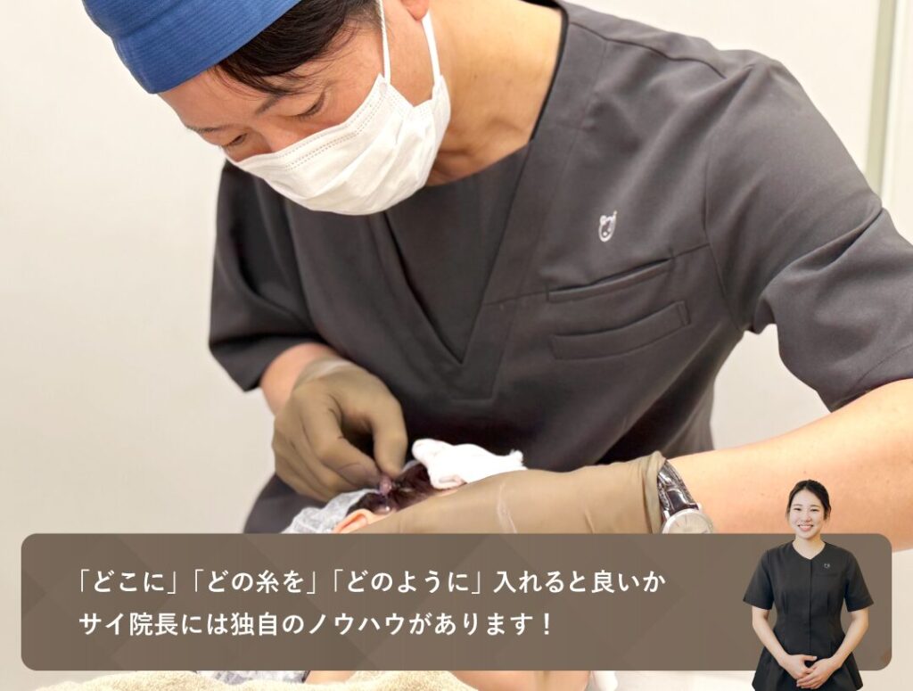 サイ院長の糸リフトはとにかく引き出しが多いんです!