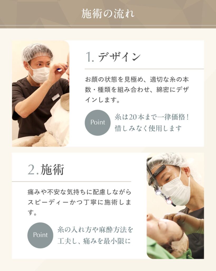 糸リフト 施術の流れ