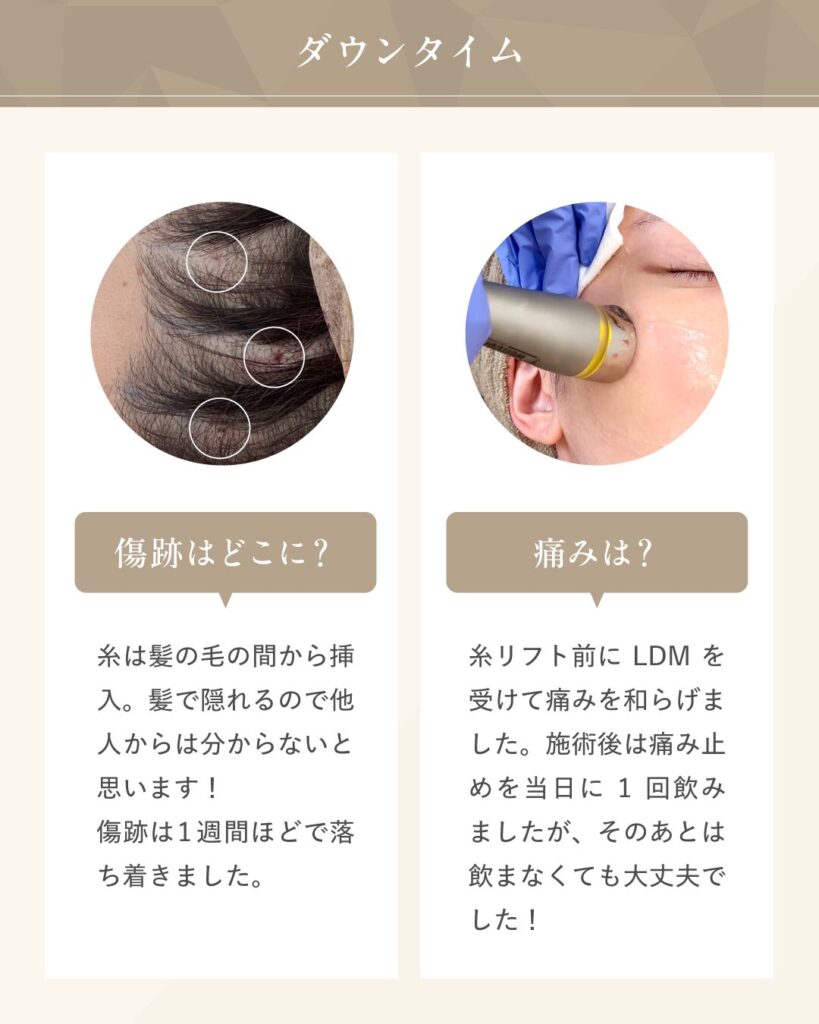 糸リフトの痛みやダウンタイム