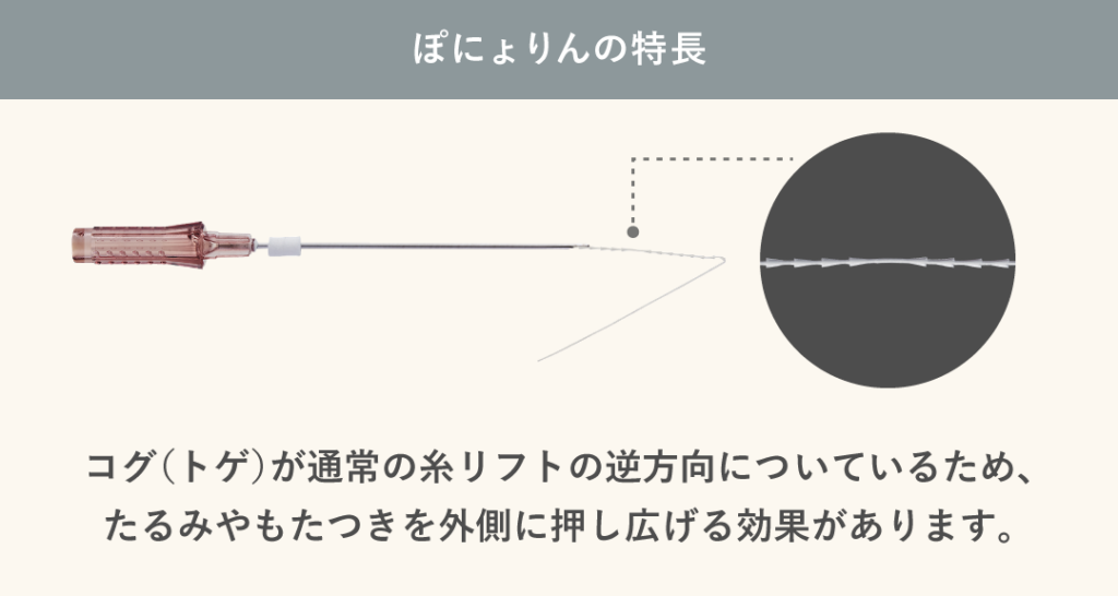 ぽにょりんの特長